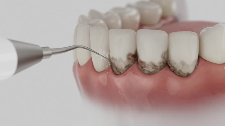 Trusted Dental Implants service in Elkridge, MD - Dentist Open Now
